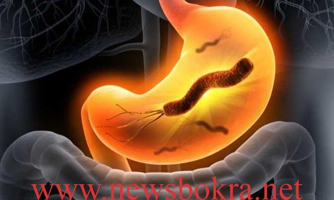 أعراض جرثومة المعدة Helicobacter pylori والأشخاص المعرضين للإصابة بها 1 أعراض جرثومة المعدة Helicobacter pylori والأشخاص المعرضين للإصابة بها 1